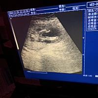 十六周做B超查的是女宝，懂的宝妈可以看出来吗？