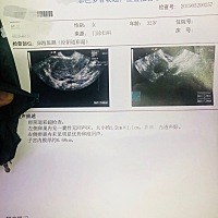 最后一次例假5.9号。5.24 打了排卵针。5.25 26安排同房。但是今天都没消息。 下一步要怎么看啊。是不是...