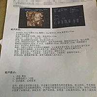 网上好多看男宝女宝的，不看不纠结，看了老纠结了，都不知道到底是女孩，男孩了，双顶径，股骨长，大于2...