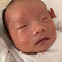 宝宝现在是十一天了 从一周左右鼻翼两侧开始起湿疹 以为是吃奶贴着太热引起的 但现在脸上和头上都长满了...