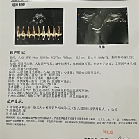 怀孕到现在才胖了15斤，宝宝还较大，本来就吃不多，医生还叫我不用吃太多。