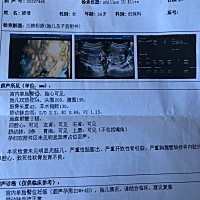 胎位不正，还偏小，6个月胎盘1级会不会有点成熟了啊？