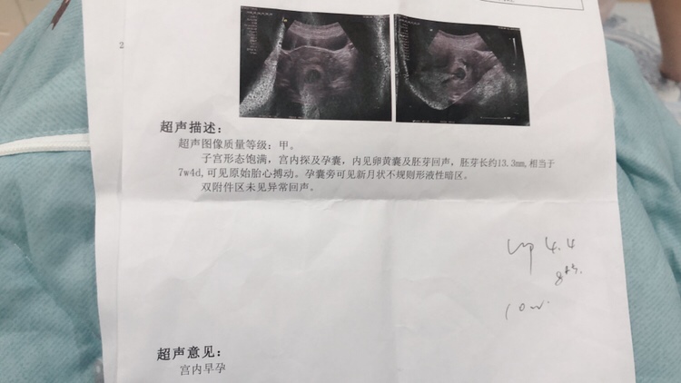 末次月经4月4日，昨天检查的b超报告单！大家帮忙看看怎么样？
