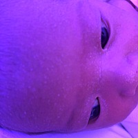 亲爱的宝妈们，我的宝宝额头，眼皮，脖子下，好多白色泡泡，类似粉刺的哪种请问宝妈们有谁知道这是什么...