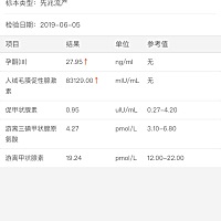 看看这个有没什么问题啊