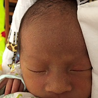 各位宝妈，宝宝额头上头白色的小米米是怎么了？