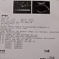 各位大神帮我看看是男宝还是女宝，比较好奇嘿嘿