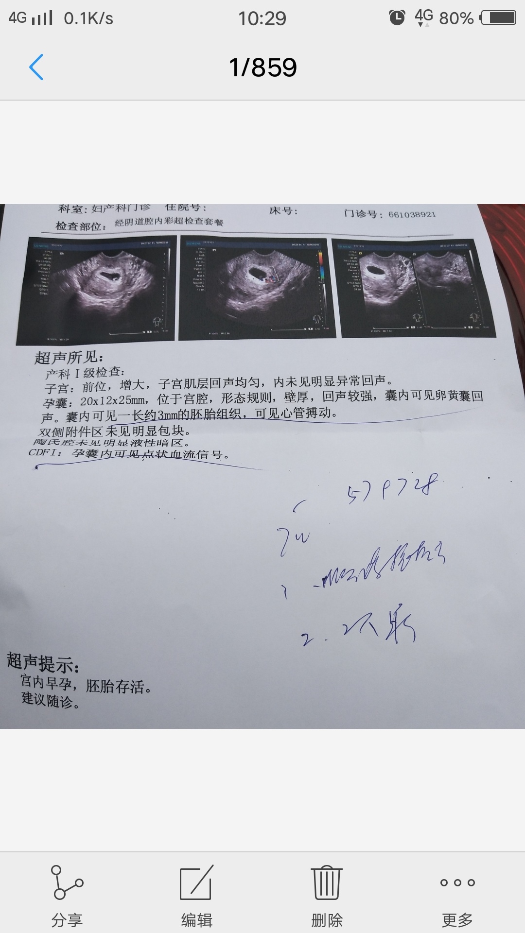 因为一胎是儿子，现在想要个女儿，想儿女双全😊