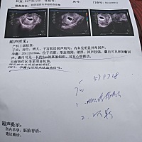 都说圆形的是女儿，茄子形的是儿子？是真的吗？那个宝妈生了的可以告知一下？ 因为一胎是儿子，现在想要...