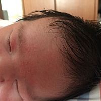 各位有经验的宝妈们帮忙看看我家宝宝额头上长的是湿疹还是痱子？两边脸颊也有一点