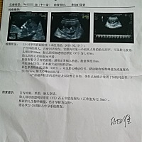 这是之前做的NT，朋友们帮我看看正常？？？🙏🙏🙏