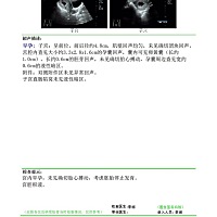 和老公的第一个宝宝就这样没了，不敢让爷爷奶奶知道，怕他们伤心。我和老公在外地，下周就要去手术了，...