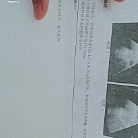 是不是情况不好了，特别担心，还是太早了点 不淡定了开始