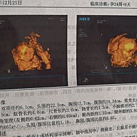麻烦会看的看哈是男是女