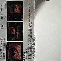 11周做的检查，医生说可以吃钙片了，请问大家吃的是什么牌子的钙片？是自己买的还是医生开的？求告知，...