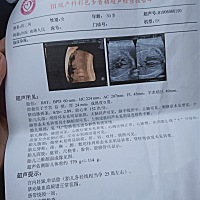 大家帮忙看看是佩奇还是乔治😂😂