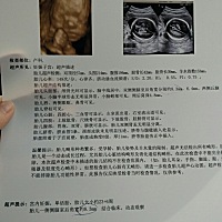 各位宝妈们好，这是我23周 6做的四维，有经验的宝妈们能看出男宝女宝吗😊😊
