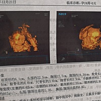 亲们帮看看是男是女