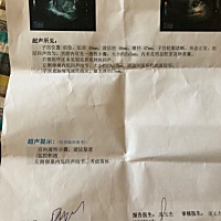 这是怎么回事，麻烦各位朋友帮忙看看谢谢