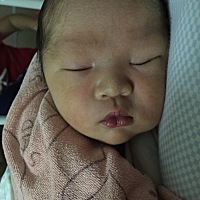 剖腹产已经第十天了，尿道还是疼，走路有坠感的疼，有宝妈一样的情况？