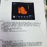 各位宝妈看看是男是女啊