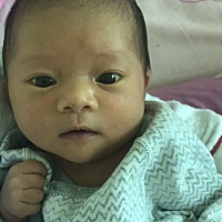 我家宝宝17天了 黄疸17点多  着急啊