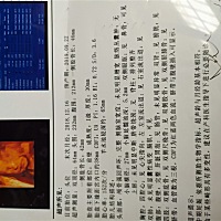 四维顺利通过，就是不知道男孩女孩，有懂的吗？纯属娱乐- ̗̀(๑ᵔ⌔ᵔ๑)