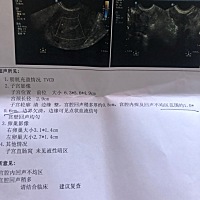 5.23人流，术后14天到现在一直出血。亲爱的们，有没有经验的姐妹。我自从14天去医院复查回来就一直在流...