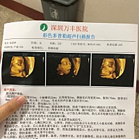 没有拍到手，但是有在检查的时候看到手手，我想问一下大家，像男孩还是女孩哈哈哈，纯属娱乐