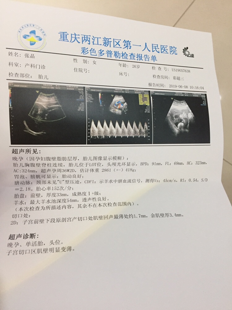 有疤痕子宫的宝妈吗？心里有些担忧，希望能稳到足月。