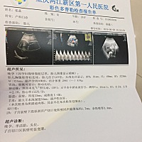 有疤痕子宫的宝妈吗？心里有些担忧，希望能稳到足月。