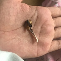 宝宝的脐带终于在他出生24天脱落了😝😝😝有比我家宝宝还迟脱落脐带的吗？