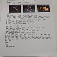 刚刚做了四维，大家帮忙看看能不能看出来是男宝宝还是女宝宝，谢谢啦😊