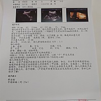 刚刚做了四维