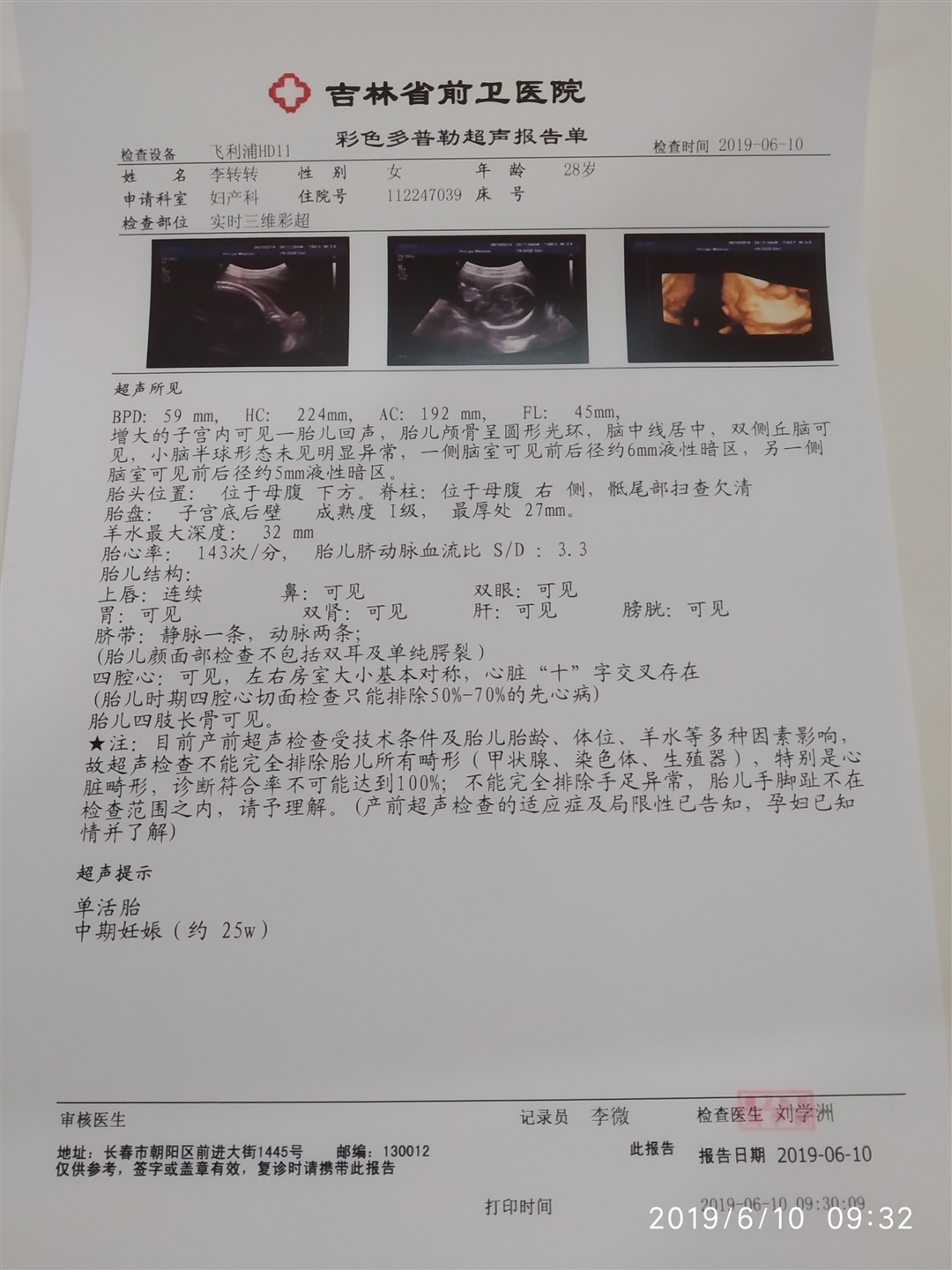 刚刚做了四维，大家帮忙看看