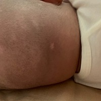 大家有懂得吗帮忙看看宝宝头上 一点点白是什么 好像那位置没头发 最近两三天才开始有的 有五六个白点