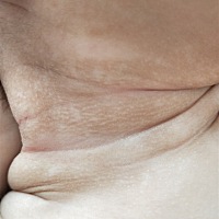 请教各位有经验的宝妈们，宝宝脖子上的皮肤黑一片白一片的，是什么原因？