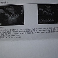 有人晓得这是男娃女娃不😌好奇
