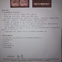 宝宝有四斤了，下个月就可以卸货啦！搞的我每天晚上都睡不好觉