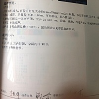 请问有人遇到这种情况吗？12周产检孕囊形态不规则，是不是发育不好？（附图百度说得很吓人，说会流产发...
