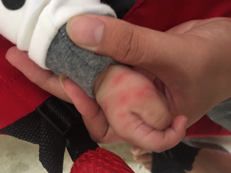 第一次发现的时候