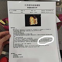 有谁知道胎儿左心室内有强光是怎么回事 有宝妈遇到这样的情况不？