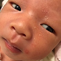 新手妈妈 求指教  谢谢~ 16天宝宝脸上的痘痘是什么情况 新手妈妈不懂 请指教指教  谢谢各位宝妈~