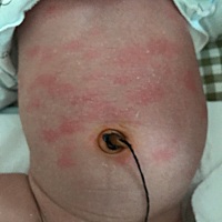 有经验的宝妈们，你们知道这是怎么回事吗？今天突然间起的，宝宝23天，有什么办法可以解决？求助，感谢...