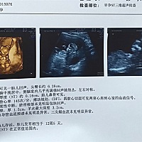 有没有经验的宝妈给看看，是男宝还是女宝哈哈哈😁 挺好奇的～ 虽然也不一定准吧