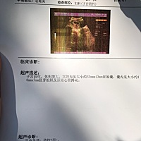 前天拍的，7周+这个数值正常吗？有懂的宝妈帮看吗？