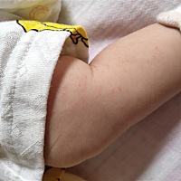 有人知道宝宝腿上有红点点是什么嘛？？