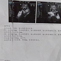 16周了     能看出男宝女宝妈