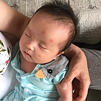 亲们，帮忙看一下孩子脸上起的这是什么痘痘，谢谢