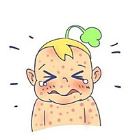 幼儿急疹一般有以下8个典型特症： 　　1.往往是突然高烧，体温迅速上升至39℃到40℃，而且会持续发...